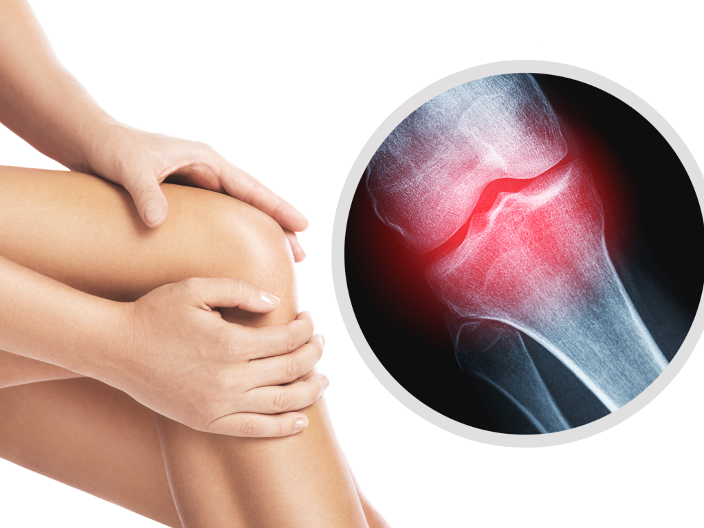 Phân biệt Viêm khớp, Thoái hóa khớp và Đau khớp – Hiểu đúng để chữa đúng